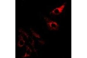 Immunofluorescent analysis of SPINK1 staining in Hela cells. (SPINK1 抗体)
