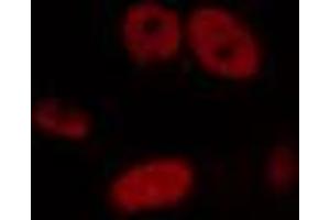 Immunofluorescence (fixed cells) (IF/ICC) image for anti-General Transcription Factor IIIC, Polypeptide 2, beta 110kDa (GTF3C2) (N-Term) antibody (ABIN6257244)