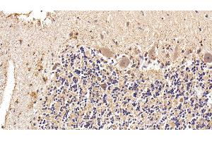Detection of GLb in Human Cerebellum Tissue using Polyclonal Antibody to Galactosidase Beta (GLb) (GLB1 抗体  (AA 68-219))