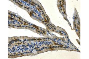 IHC analysis of AKR7A2 using anti-AKR7A2 antibody (ABIN7601157).