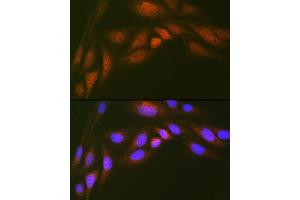 Immunofluorescence analysis of U-2 OS cells using Ube2N/Ubc13 Rabbit mAb (ABIN7271179) at dilution of 1:100 (40x lens).