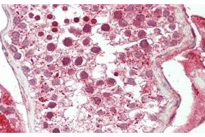 Immunohistochemistry (IHC) image for anti-Chemokine (C-X3-C Motif) Ligand 1 (CX3CL1) (AA 25-332) antibody (ABIN7438127)