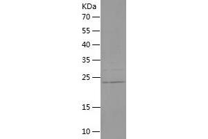 Western Blotting (WB) image for Fibroblast Growth Factor 8 (Androgen-Induced) (FGF8) (AA 53-233) protein (His tag) (ABIN7283456) (FGF8 Protein (AA 53-233) (His tag))