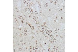 Immunohistochemistry of paraffin-embedded rat brain using /IB Rabbit pAb (2391) at dilution of 1:50 (40x lens).