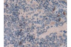 Detection of EMILIN1 in Rat Spleen Tissue using Polyclonal Antibody to Elastin Microfibril Interface Located Protein 1 (EMILIN1) (Emilin1 抗体  (AA 684-899))