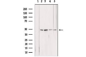 Western blot analysis of extracts from various samples, using ATPB antibody. (ATP5B 抗体  (Internal Region))
