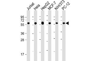All lanes : Anti-Hsp60 Antibody at 1:16000 dilution Lane 1: Jurkat whole cell lysate Lane 2: Hela whole cell lysate Lane 3: HepG2 whole cell lysate Lane 4: MCF-7 whole cell lysate Lane 5: NIH/3T3 whole cell lysate Lane 6: PC-12 whole cell lysate Lysates/proteins at 20 μg per lane. (HSPD1 抗体  (AA 396-430))