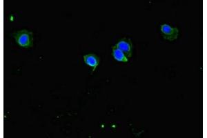 Immunofluorescent analysis of Hela cells using ABIN7148148 at dilution of 1:100 and Alexa Fluor 488-congugated AffiniPure Goat Anti-Rabbit IgG(H+L) (CCDC8 抗体  (AA 214-513))