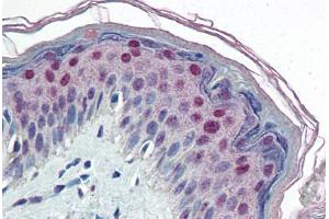 Human Skin (formalin-fixed, paraffin-embedded) stained with CEBPB antibody ABIN364320 at 10 ug/ml followed by biotinylated anti-mouse IgG secondary antibody ABIN481714, alkaline phosphatase-streptavidin and chromogen. (CEBPB 抗体)