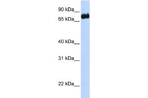 WB Suggested Anti-LRCH4 Antibody Titration:  0. (LRCH4 抗体  (N-Term))