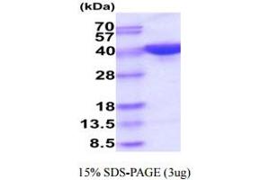 SDS-PAGE (SDS) image for Pregnancy Specific beta-1-Glycoprotein 5 (PSG5) (AA 35-335) protein (His tag) (ABIN6388077)