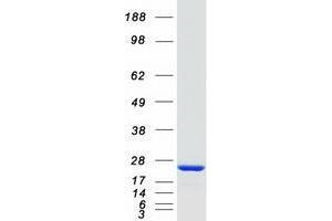 Tumor Necrosis Factor, alpha-Induced Protein 8 (TNFAIP8) (Transcript Variant 1) protein (Myc-DYKDDDDK Tag)