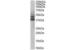 Image no. 1 for anti-Tripartite Motif Containing 54 (TRIM54) (C-Term) antibody (ABIN374312) (TRIM54 抗体  (C-Term))