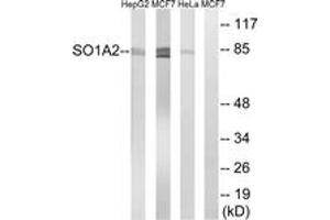 Western Blotting (WB) image for anti-Solute Carrier Organic Anion Transporter Family, Member 1A2 (SLCO1A2) (AA 251-300) antibody (ABIN2890652) (SLCO1A2 抗体  (AA 251-300))