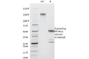 SDS-PAGE Analysis Purified CD44 Mouse Monoclonal Antibody (DF1485). (CD44 抗体)