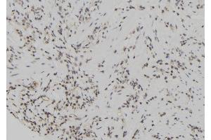 ABIN6267108 at 1/100 staining Human gastric tissue by IHC-P.