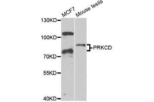 Western blot analysis of extracts of various cell lines, using PRKCD antibody. (PKC delta 抗体  (AA 477-676))