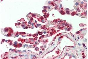 Human Lung: Formalin-Fixed, Paraffin-Embedded (FFPE) (Cofilin 抗体  (AA 4-32))
