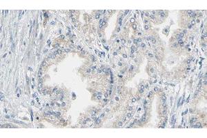 ABIN6276843 at 1/100 staining Human prostate tissue by IHC-P. (Annexin V 抗体  (C-Term))