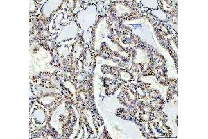 IHC analysis of FTO using anti-FTO antibody (ABIN7601059). (FTO 抗体  (AA 279-505))