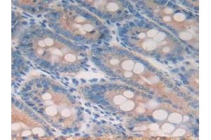 Detection of CK18 in Rat Small intestine Tissue using Polyclonal Antibody to Cytokeratin 18 (CK18) (Cytokeratin 18 抗体  (AA 72-380))