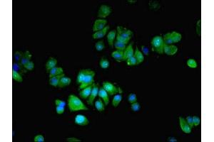 Immunofluorescent analysis of MCF-7 cells using ABIN7159082 at dilution of 1:100 and Alexa Fluor 488-congugated AffiniPure Goat Anti-Rabbit IgG(H+L) (MLX 抗体  (AA 1-244))