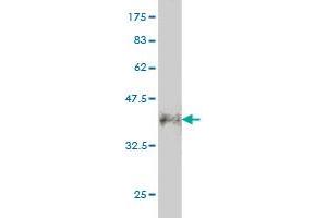 Western Blot detection against Immunogen (36. (CALCOCO2 抗体  (AA 347-446))