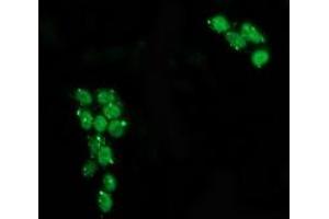 Immunofluorescence (IF) image for anti-Tumor Protein P53 (TP53) antibody (ABIN1499971) (p53 抗体)