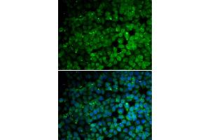 Immunofluorescence analysis of HeLa cells using TRIM13 antibody (ABIN6293541). (TRIM13 抗体)