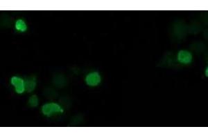 Image no. 4 for anti-Synovial Sarcoma, X Breakpoint 1 (SSX1) antibody (ABIN1501156)