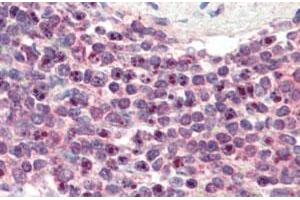 NR1H2 polyclonal antibody  (3 ug/mL) staining of paraffin embedded human spleen. (NR1H2 抗体)
