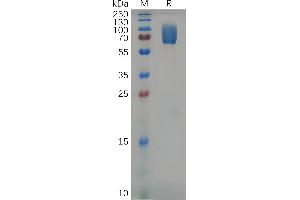 SDS-PAGE (SDS) image for Natural Killer Cell Receptor 2B4 (CD244) (AA 20-225) protein (Fc Tag) (ABIN7092849)