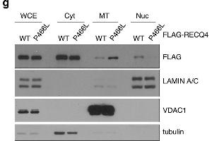 The P466L clinical mutation leads to RECQ4 mitochondrial accumulation. (DYKDDDDK Tag 抗体)