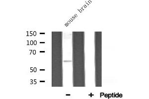 Western blot analysis of ATP5A1 expression in Mouse brain lysate (ATP5A1 抗体  (Internal Region))