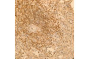Immunoperoxidase of monoclonal antibody to AKAP13 on formalin-fixed paraffin-embedded human spleen. (AKAP13 抗体  (AA 1-110))