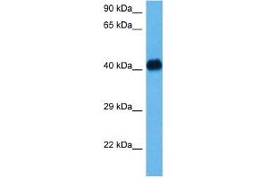 Host:  Mouse  Target Name:  NFKBIB  Sample Tissue:  Mouse Heart  Antibody Dilution:  1ug/ml (NFKBIB 抗体  (N-Term))