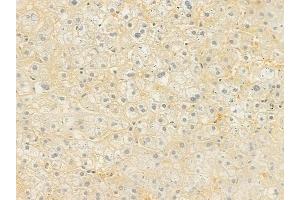 ABIN6262011 and ABIN6277630 at 1/100 staining human normal liver tissue by IHC-P. (GNAS 抗体  (C-Term))