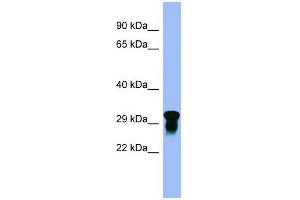 WB Suggested Anti-C10orf54 Antibody Titration:  0. (VISTA 抗体  (N-Term))