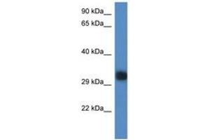 Image no. 1 for anti-Predicted Gene 527 (GM527) (AA 218-267) antibody (ABIN6746331) (GM527 抗体  (AA 218-267))