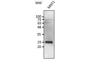 Anti-Rab38 Ab at 1/2,500 dilution, Iysates at 50 µg per Iane, rabbit polyclonal to goat (HRP) at 1/10,000 dilution, (RAB38 抗体  (C-Term))