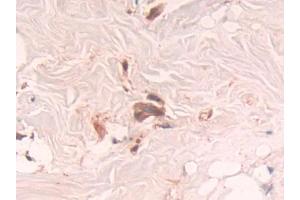 Used in DAB staining on fromalin fixed paraffin-embedded Brain tissue (RNASET2 抗体  (AA 25-256))
