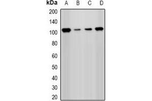 Western blot analysis of PHC1 expression in Hela (A), Jurkat (B), A549 (C), mouse kidney (D) whole cell lysates. (PHC1 抗体)