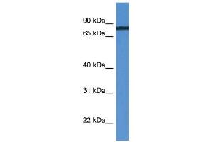 WB Suggested Anti-HHIPL1 Antibody Titration: 0. (HHIPL1 抗体  (C-Term))