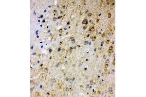 Anti-Rab5 antibody, IHC(P) IHC(P):Rat Brain Tissue