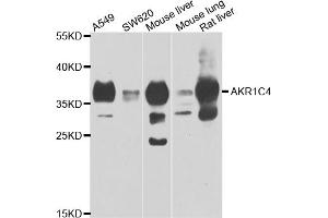 Western blot analysis of extracts of various cell lines, using AKR1C4 antibody (ABIN5975529) at 1/1000 dilution. (AKR1C4 抗体)