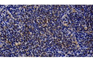 Detection of TLR5 in Rat Spleen Tissue using Polyclonal Antibody to Toll Like Receptor 5 (TLR5) (TLR5 抗体  (AA 325-644))