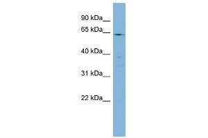 CYP4F3 antibody used at 1 ug/ml to detect target protein. (CYP4F3 抗体  (N-Term))