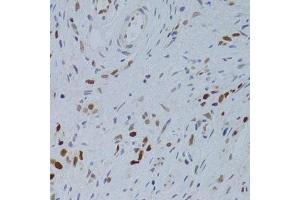 Immunohistochemistry (Paraffin-embedded Sections) (IHC (p)) image for anti-Nuclear Autoantigenic Sperm Protein (Histone-Binding) (NASP) (AA 180-449) antibody (ABIN6144374)