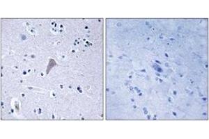 Immunohistochemistry analysis of paraffin-embedded human brain tissue, using mTOR (Ab-2448) Antibody. (MTOR 抗体  (AA 2415-2464))