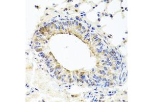 Immunohistochemistry of paraffin-embedded mouse lung using MUC16 antibody (ABIN6003713) at dilution of 1/100 (40x lens). (MUC16 抗体)